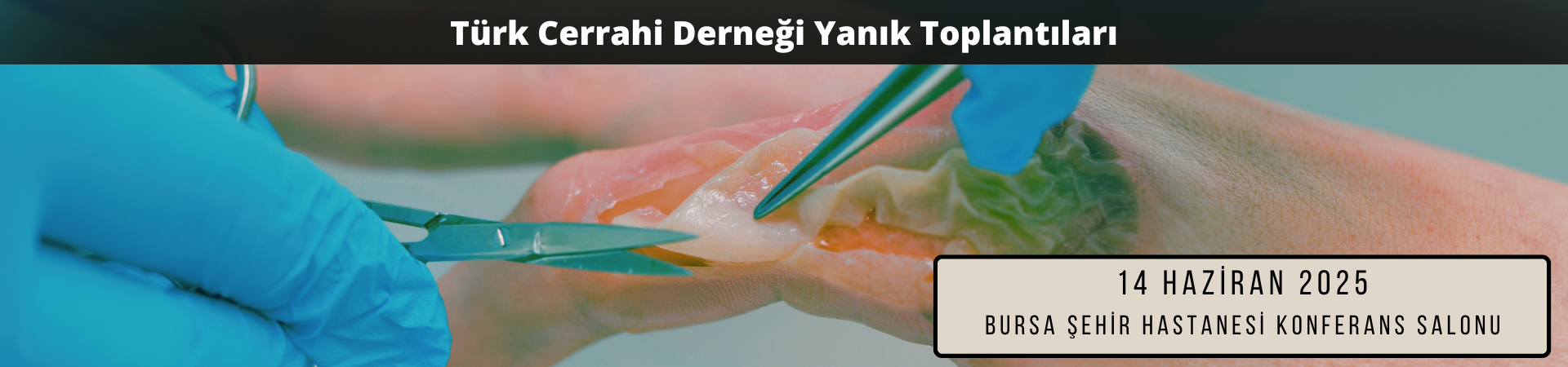 Türk Cerrahi Derneği Yanık Toplantıları - 1