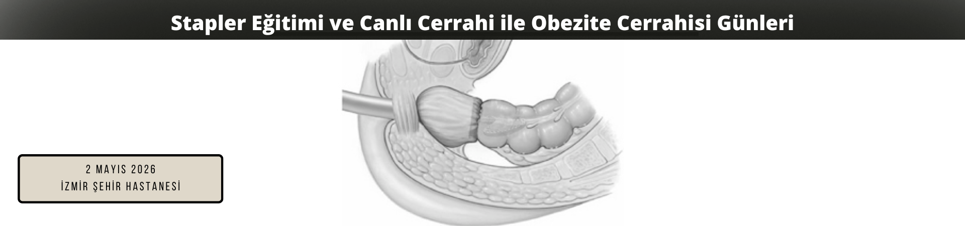 Stapler Eğitimi ve Canlı Cerrahi ile Obezite Cerrahisi Günleri